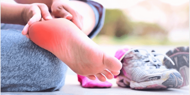 Plantar Fasciitis