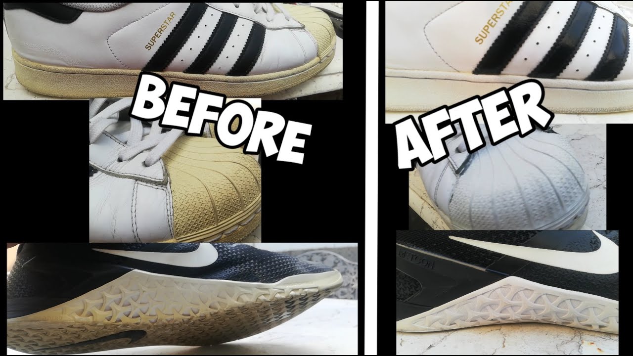 How to Remove Yellow Stains From White Adidas Shoes?