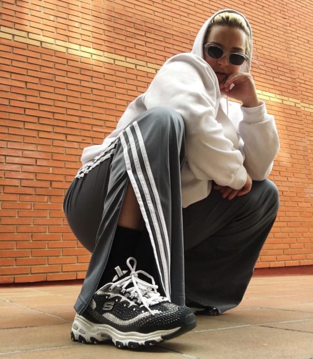 Why Do People Hate Skechers?