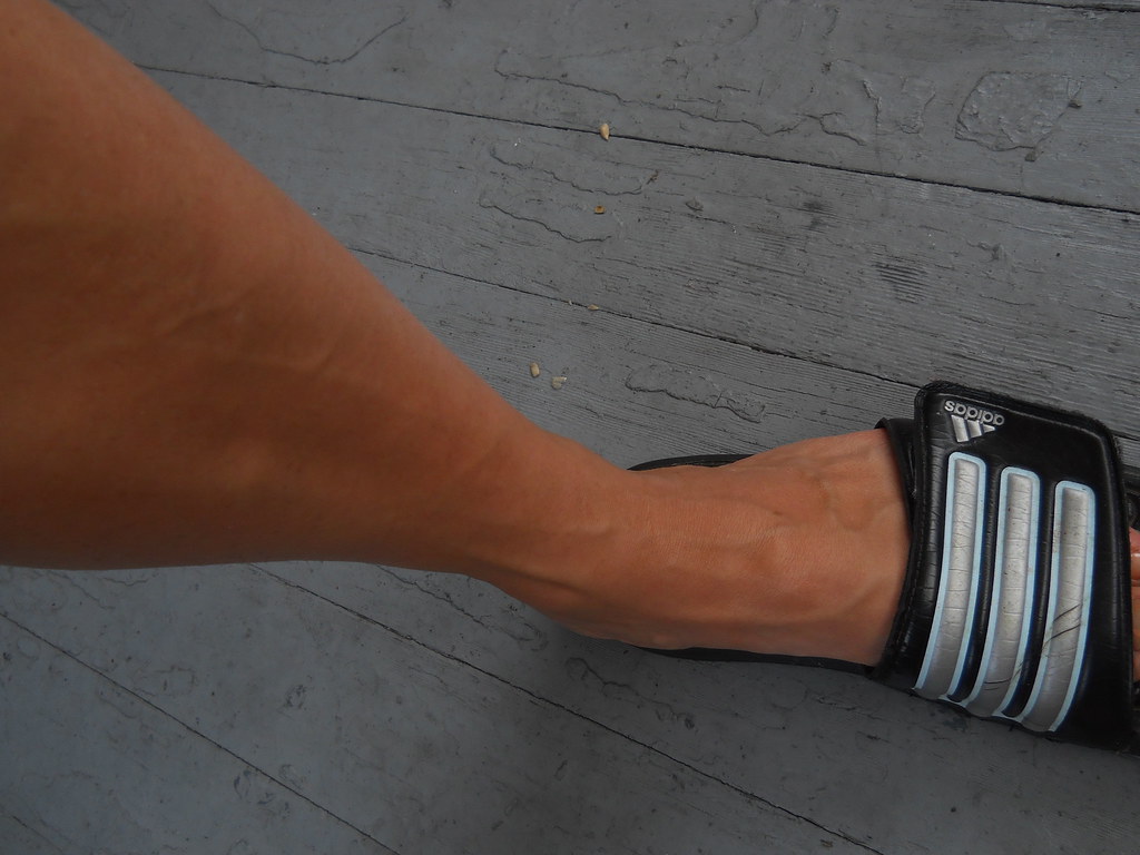 How Much Is Adidas Adilette?